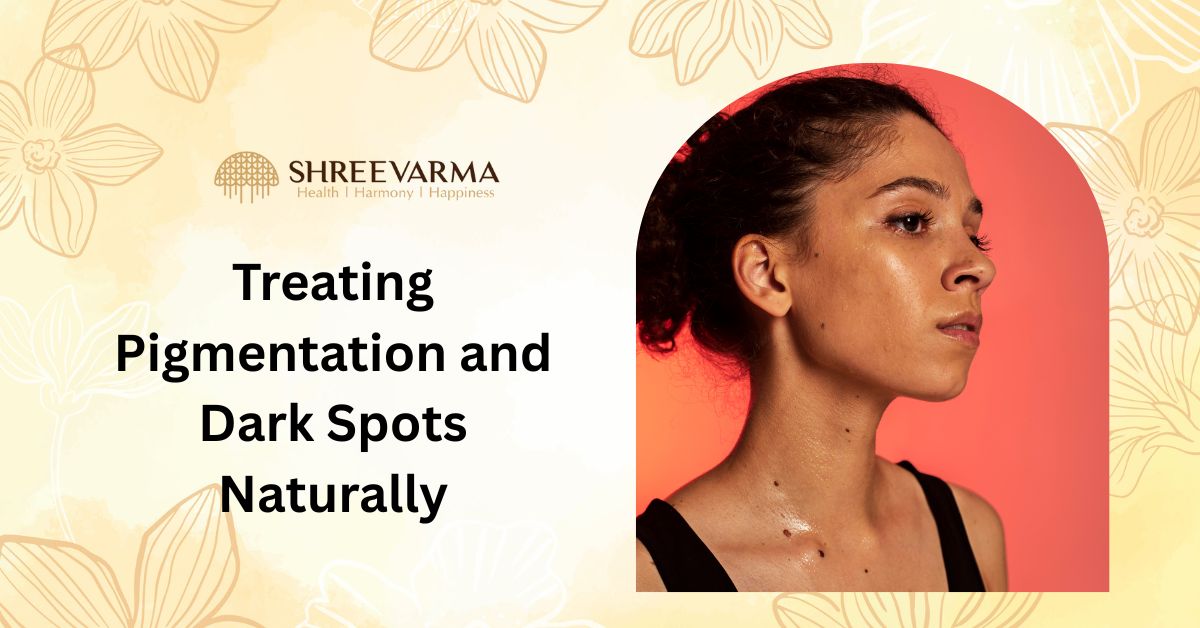 Treating Pigmentation and Dark Spots Naturally