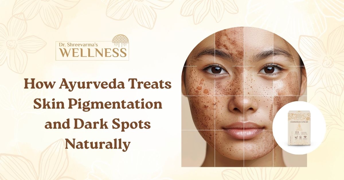 How Ayurveda Treats Skin Pigmentation and Dark Spots